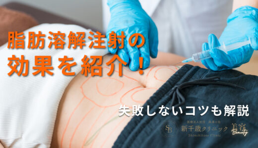 脂肪溶解注射の効果を紹介！失敗しないコツも解説