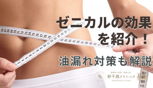ゼニカルの効果を紹介！油漏れ対策も解説