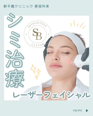 【シミ・そばかすでお悩みの方におすすめ💖】

こんにちは！新千歳クリニックです！
今回は【レーザーフェイシャル】のご紹介です🌟

レーザーフェイシャルとは、レーザーを顔全体に照射することで、シミの原因となるメラニンに反応させる治療法です。
当院では、医療脱毛にも使用されている「ジェントルマックスプロ」を用いて、シミやくすみの治療を行います🥹💖

気になる方はカウンセリングのみでご予約も可能ですので、ぜひご相談ください！

〈料金〉
1回 22,000円(税込)
5回セット 88,000円(税込)

〈副作用・リスク〉
＊赤み
レーザー治療後に肌が赤くなることがあります。通常、数時間から数日で収まりますが、敏感な肌の人はもう少し長く続くことがあります。
＊腫れ
施術後に軽い腫れが見られることがありますが、これも通常は数日以内に治まります。
＊乾燥と剥がれ
レーザーによって肌が乾燥し、軽い剥がれが生じることがあります。適切な保湿が必要です。
＊色素沈着
一部の人は、治療後に色素沈着（シミ）が見られることがあります。特に、治療後の日焼けや色素が多い肌には注意が必要です。
＊感染
非常に稀ですが、感染のリスクも存在します。適切なアフターケアを行うことでリスクを最小限に抑えられます。
＊過敏反応
まれに、肌が過敏になることがあります。アレルギー反応が出る場合もあるため、施術前にパッチテストを行うことが推奨されることがあります。

*✧･ﾟ: *✧･ﾟ:*✧･ﾟ: *✧･ﾟ:*✧･ﾟ: *✧･ﾟ:

新千歳クリニック 美容外来
〒066-0026 北海道千歳市住吉4丁目2-3
TEL 0123-22-8600

Dr. @yasunao.miyai
NS @goto_artmake
NS @tanikoshi_artmake

ご予約は美容外来公式LINEから
【http://lin.ee/ALoek2E】
WEB予約もできます！
【http://shinchitose.reserve.ne.jp】
ホームページ
【http://beauty.shinchitose-clinic.com】

*✧･ﾟ: *✧･ﾟ:*✧･ﾟ: *✧･ﾟ:*✧･ﾟ: *✧･ﾟ:

#新千歳クリニック#千歳市#千歳市クリニック#美容外来#美容#beauty#美肌#女子力#スキンケア#ビューティー#followme#美白#ニキビ#綺麗になりたい#毛穴#にきび#リフトアップ#レーザートーニング#ニキビ跡#レーザー#くすみ#艶肌#美容day#美容女子#美容男子#ジェントルマックスプロ#医療脱毛#レーザーフェイシャル